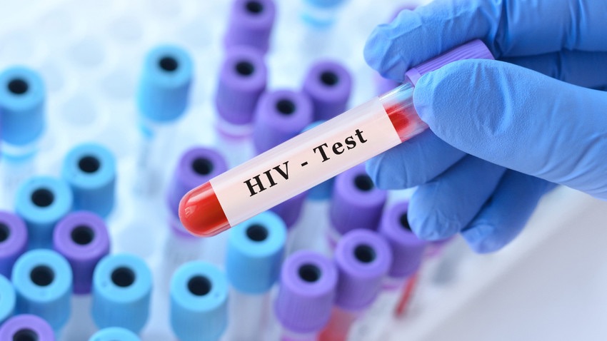 HIV’e Karşı Tarihi Başarı: Kemik İliği Nakliyle İyileşti